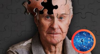 ¿Puedes evitar el Alzheimer?, descubre los secretos para reducir el riesgo