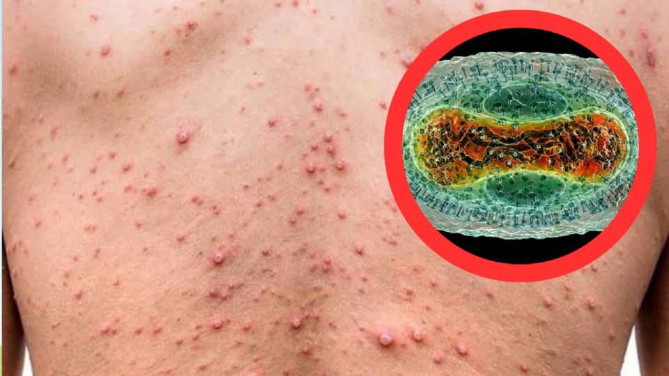 La Secretaría de Salud (Ssa) lanzó una alerta preventiva de viaje por aumento de casos de 'mpox'