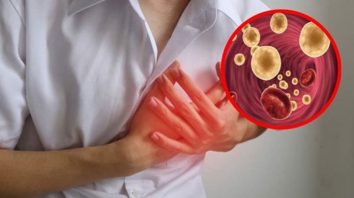 Estos son los alimentos que elevan el riesgo de sufrir un infarto, según expertos
