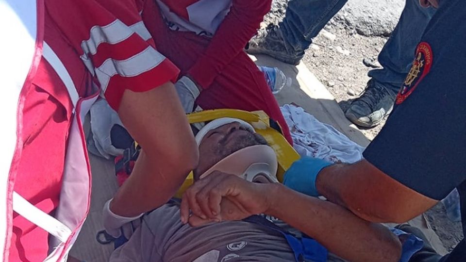 El ciclista quedó muy lastimado después de ser atropellado