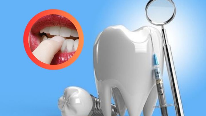 Conoce los mejores remedios naturales que te ayudarán a blanquear los dientes