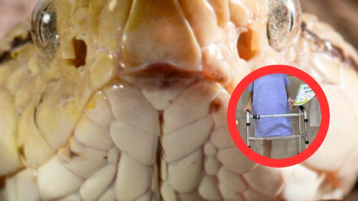 Letal serpiente muerde tres veces a niño; le amputan una pierna