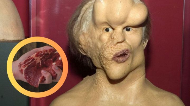 Esta es la enfermedad más rara del mundo, ¿existe en México?