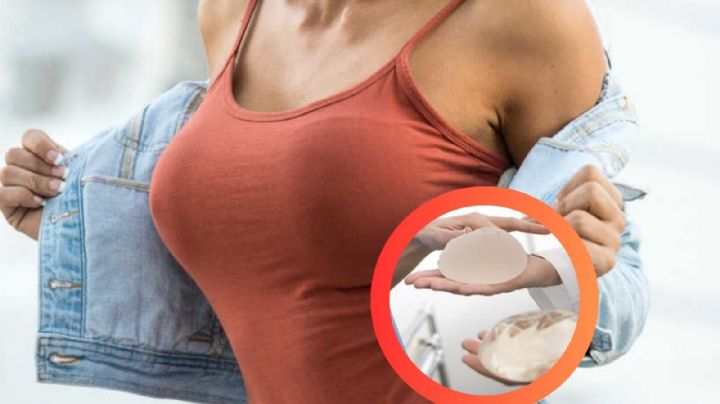Implantes de senos: ¿Son para siempre o necesitan reemplazo?