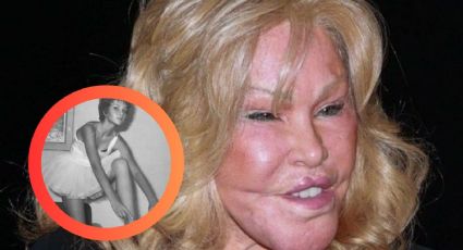 Muere Jocelyn Wildenstein, la ‘Mujer gato’, a los 84 años en París