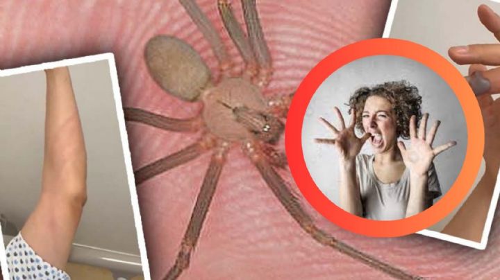 El veneno tóxico de la araña violinista podría estar más cerca de lo que piensas; ¿cómo evitarlo?