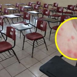 Virus de Coxsackie: confirman primer caso en una estudiante de secundaria en Tamaulipas