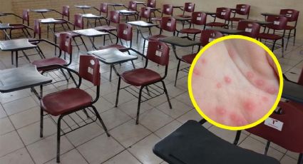 Virus de Coxsackie: confirman primer caso en una estudiante de secundaria en Tamaulipas  