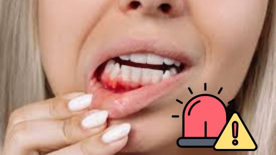 Esta enfermedad puede causar terribles consecuencias si no se trata a tiempo