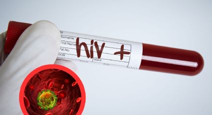 Nuevo Laredo: detectan 55 nuevos casos de personas con VIH/sida