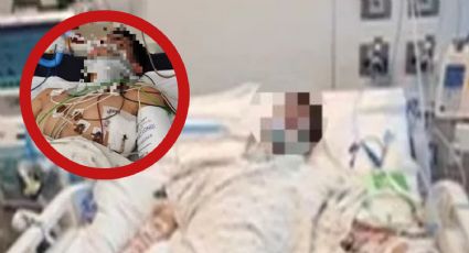 Policía investiga brutal atropellamiento de menor en Laredo; está grave