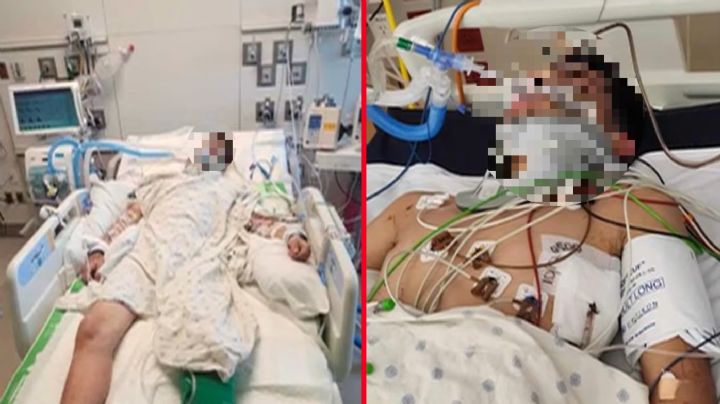 Laredo: investigan brutal ataque contra menor; su madre de Nuevo Laredo pide justicia