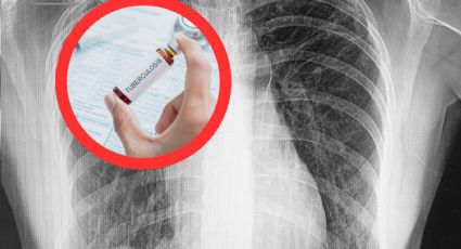 Nuevo Laredo: esperan 300 niños que llegue la vacuna BCG