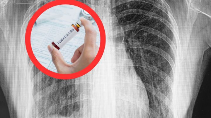 Nuevo Laredo: esperan 300 niños que llegue la vacuna BCG