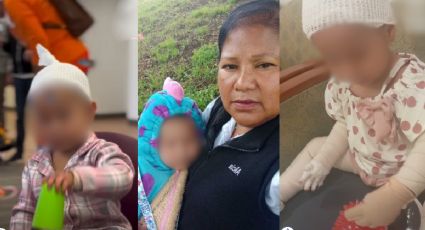 Tras más de un mes de rehabilitación, así luce Jazlyn, la bebé salvada por su abuela en la explosión de Iztapalapa