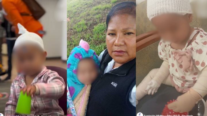 Tras más de un mes de rehabilitación, así luce Jazlyn, la bebé salvada por su abuela en la explosión de Iztapalapa