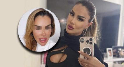 Ninel Conde sorprende con impresionante cambio tras someterse a cirugía estética; ¿qué se operó? | VIDEO