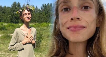 Muere mujer de 27 años que comía solo frutas y pesaba 22 kilos; ¿qué le pasó?