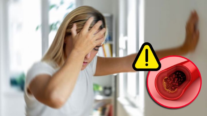 Derrame cerebral: este síntoma puede detectar el ataque antes de que sea muy tarde