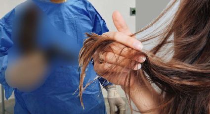 Niña de 10 años es operada de emergencia; esto tenía en el estómago