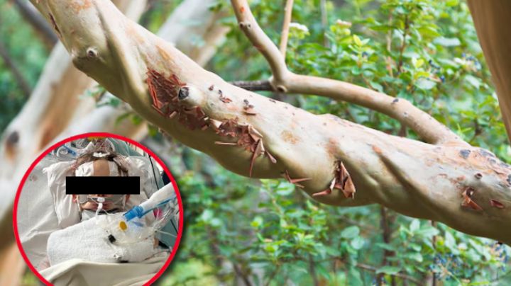 Niño muere trágicamente tras caerle rama de un árbol; padres demandan a la ciudad por negligencia