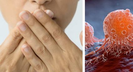 Cáncer y mal aliento: la señal silenciosa que podría anticipar una enfermedad grave