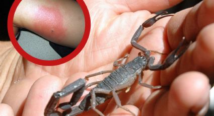 Animales ponzoñosos: alerta en México por picadura de alacrán; reportan 35 casos cada hora