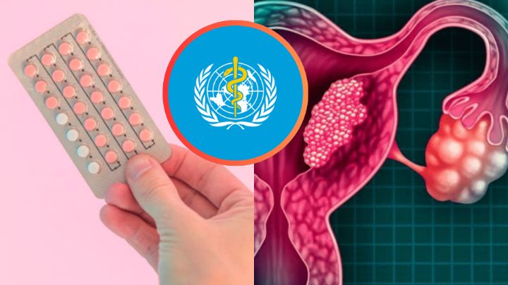 ¿La píldora anticonceptiva es cancerígena? La OMS revela la respuesta en estudio