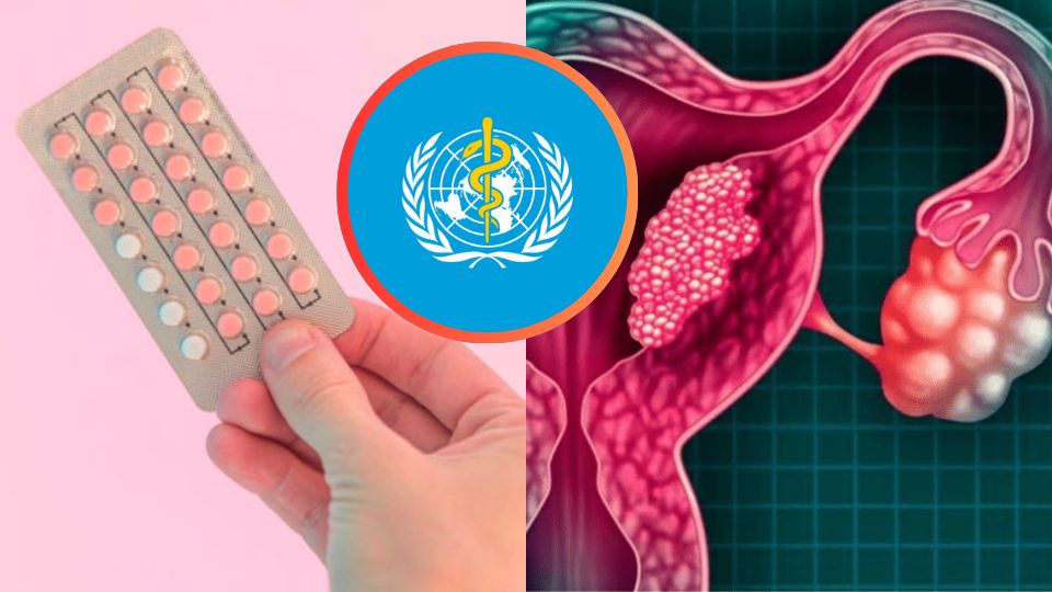 ¿La píldora anticonceptiva produce cáncer cervicouterino? La OMS revela la respuesta en estudio; pide no alarmarse