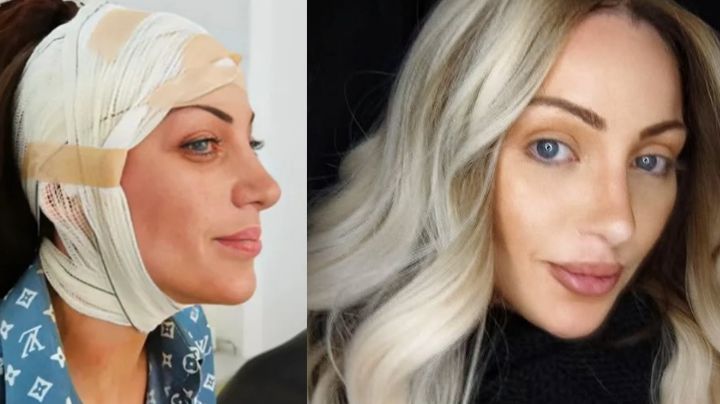 Encuentran el cadáver de la ‘Barbie Humana’; tenía más de 27 cirugías estéticas, ¿de qué murió?