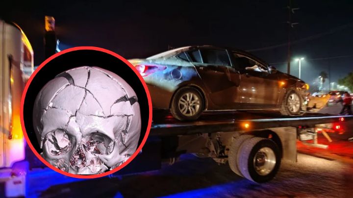 Menor de 13 años se encuentra grave tras accidente en motocicleta; sufre traumatismo craneoencefálico