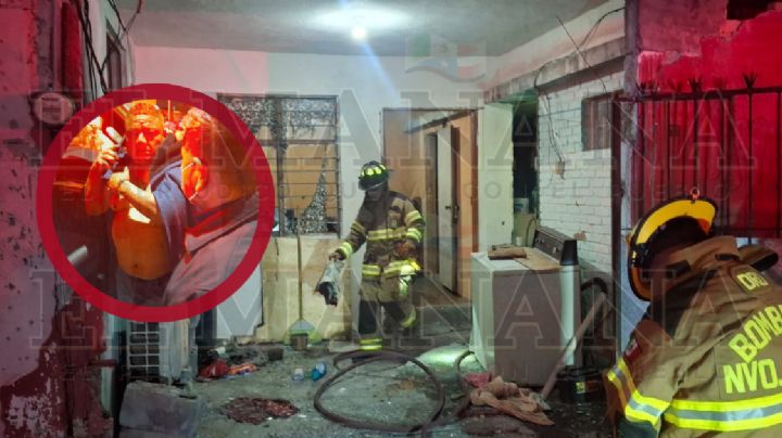 Perros causan terrible accidente en la colonia Hipódromo; mandan a hombre grave al hospital