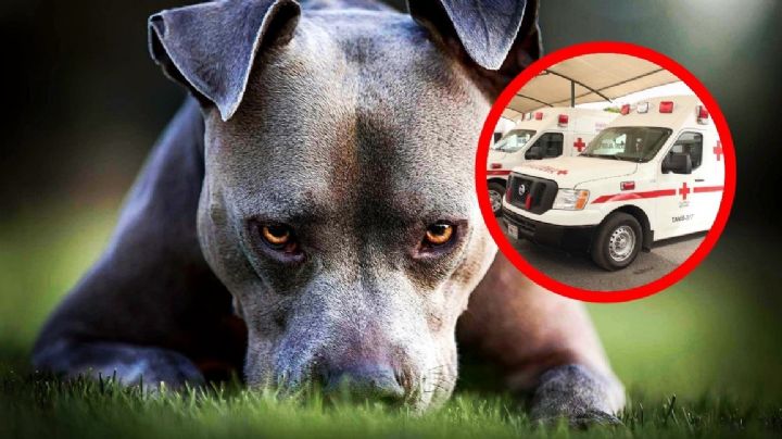 Bebé de un año muere tras ataque agresivo de pitbull; le rompió el cráneo a mordidas