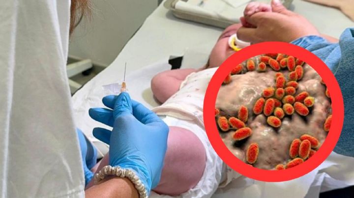 Alerta por el regreso de una antigua enfermedad; decenas de niños han muerto