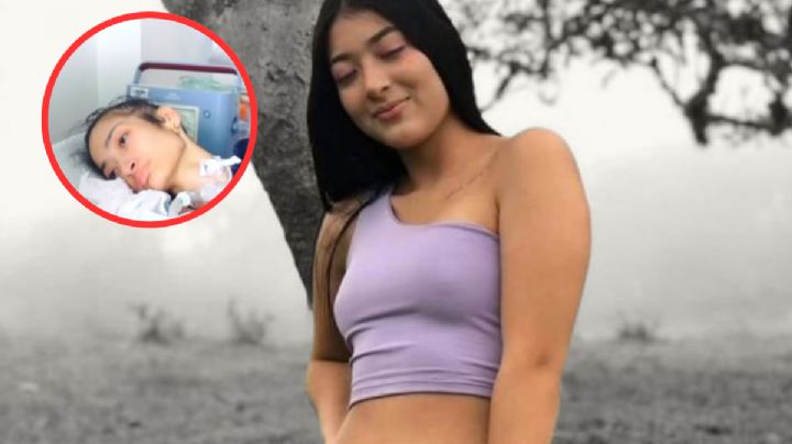 Botellazo acaba con la carrera de joven modelo; hoy busca recurrir a la eutanasia