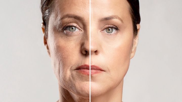 Tratamientos para estirar la cara y borrar las líneas de expresión sin cirugía; opciones y costos