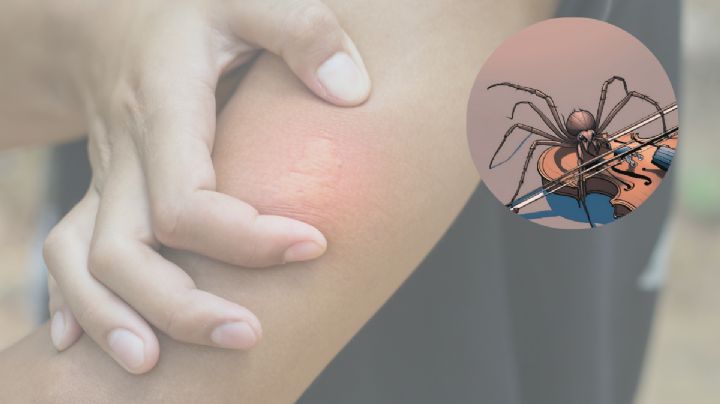 Araña violinista: ¿cuánto mide este letal arácnido?; así la puedes identificar