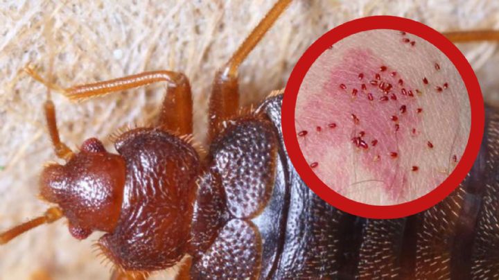 Chinches en México: ¿cuándo empieza la temporada y cómo se propagan tan rápido?