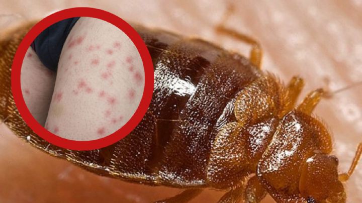 Chinches en tu casa: ¿qué hacer si te picó una y qué tan peligroso es?