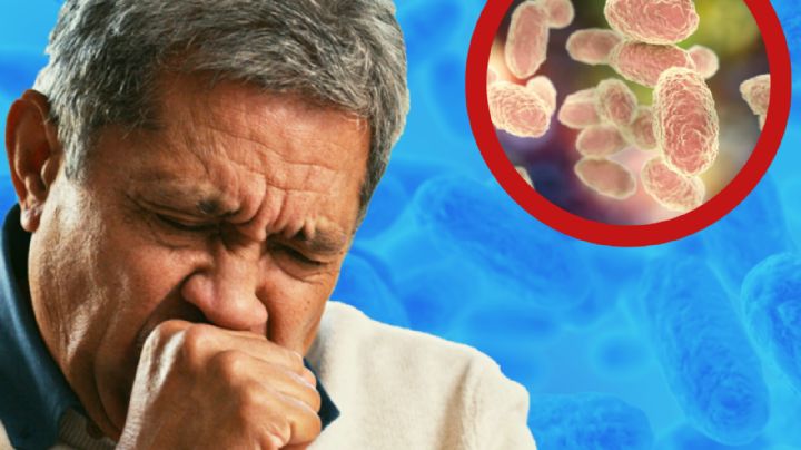 Estos son los estados con más casos de tos ferina en México; Nuevo León encabeza la lista