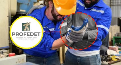 LFT: si pierdes dedos de la mano trabajando, ¿cómo te deberían de indemnizar según la ley?