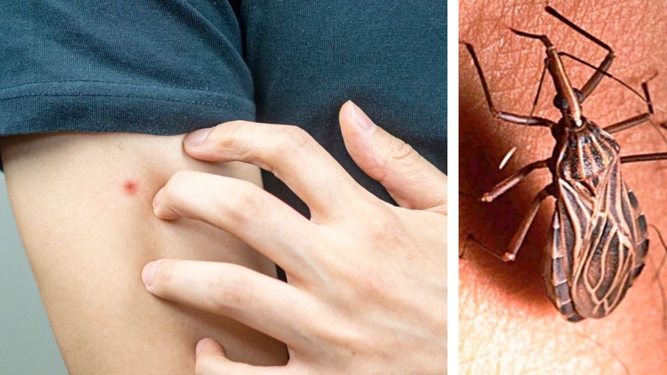 El peligroso mal de chagas.