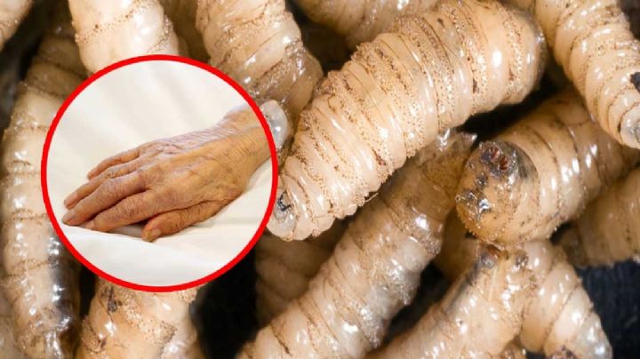 Alerta: confirman primer caso humano de gusano barrenador del ganado en México