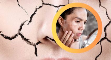 ¿Sientes la piel más flácida?, el calor podría ser el culpable; así podrías evitarlo
