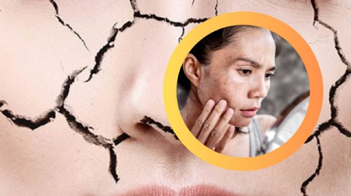 ¿Sientes la piel más flácida?, el calor podría ser el culpable; así podrías evitarlo