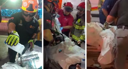 Manita de bebé de 18 meses queda atrapada en molino de carne; quijadas de la vida la salvan