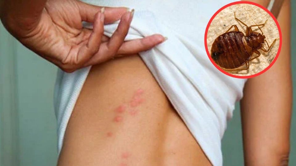 Las chiches podrían provocarte una enfermedad que podría confundirse con una infección estomacal