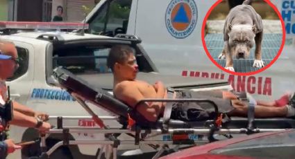 Hombre es atacado por sus perros pitbull dentro de su casa; los usaba para peleas clandestinas