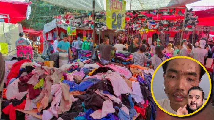 ¿Compras ropa de paca?, así debes lavar las prendas antes de usarla para evitar infecciones en la piel | VIDEO