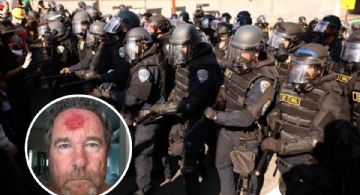 Policía dispara a la cabeza de fotógrafo durante protestas en Los Ángeles | VIDEO